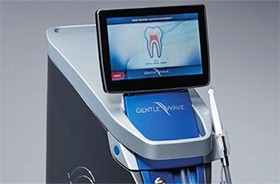 GentleWave system