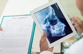 Dental chart and full face x-rays