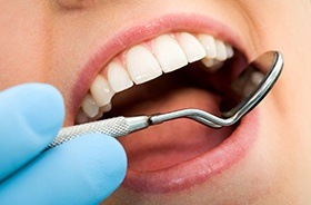 Closeup of patient during dental exam