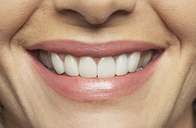 Closeup of healthy smile