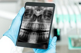 Digital x-rays on tablet computer